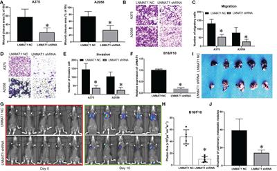 Corrigendum: LNMAT1 Promotes Invasion-Metastasis Cascade in Malignant Melanoma by Epigenetically Suppressing CADM1 Expression